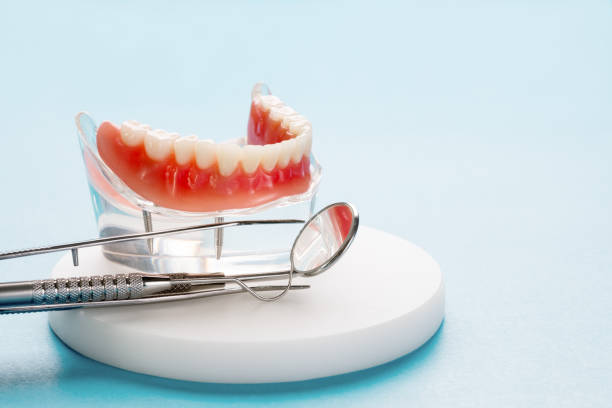 Full Mouth Reconstruction in Newark, CA
